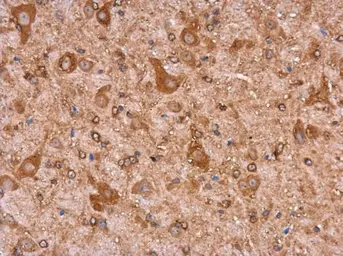 Anti-MYH9 antibody [GT218] used in IHC (Paraffin sections) (IHC-P). GTX633295