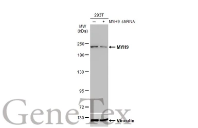 Anti-MYH9 antibody [GT218] used in Western Blot (WB). GTX633295