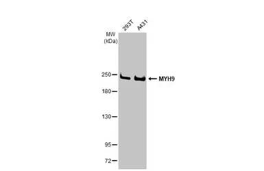 Anti-MYH9 antibody [GT218] used in Western Blot (WB). GTX633295