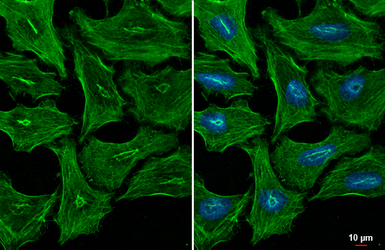 Anti-MYH9 antibody [GT218] used in Immunocytochemistry/ Immunofluorescence (ICC/IF). GTX633295