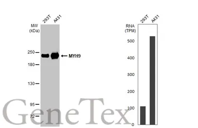 Anti-MYH9 antibody [GT218] used in Western Blot (WB). GTX633295