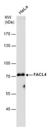 Anti-FACL4 antibody [GT186] used in Western Blot (WB). GTX633365