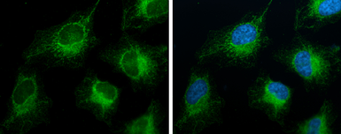 Anti-FACL4 antibody [GT186] used in Immunocytochemistry/ Immunofluorescence (ICC/IF). GTX633365
