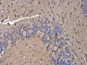Anti-FACL4 antibody [GT186] used in IHC (Paraffin sections) (IHC-P). GTX633365