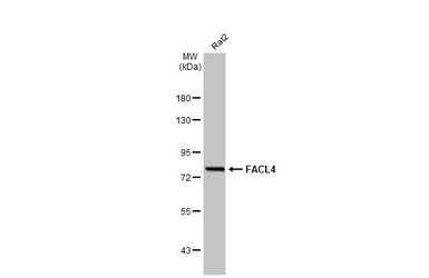 Anti-FACL4 antibody [GT186] used in Western Blot (WB). GTX633365