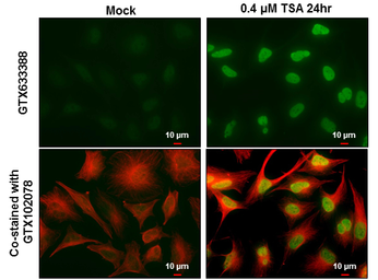 Anti-Histone H2AK5ac (acetyl Lys5) antibody [GT1262] used in Immunocytochemistry/ Immunofluorescence (ICC/IF). GTX633388