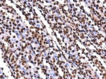 Anti-Histone H2AK5ac (acetyl Lys5) antibody [GT1262] used in IHC (Paraffin sections) (IHC-P). GTX633388