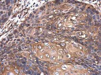 Anti-ROCK2 antibody [GT11712] used in IHC (Paraffin sections) (IHC-P). GTX633389