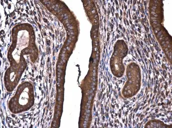 Anti-ROCK2 antibody [GT11712] used in IHC (Paraffin sections) (IHC-P). GTX633389