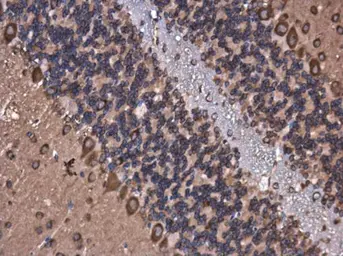 Anti-ROCK2 antibody [GT11712] used in IHC (Paraffin sections) (IHC-P). GTX633389