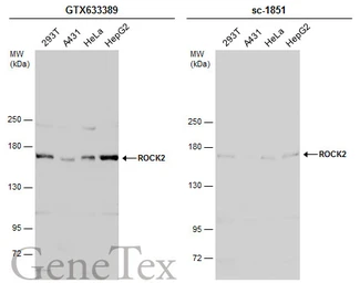 Anti-ROCK2 antibody [GT11712] used in Western Blot (WB). GTX633389