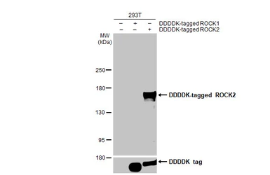 Anti-ROCK2 antibody [GT11712] used in Western Blot (WB). GTX633389