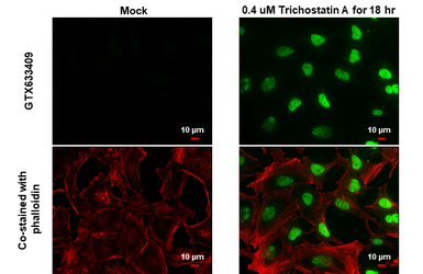 Anti-Histone H2BK20ac (acetyl Lys20) antibody [GT578] used in Immunocytochemistry/ Immunofluorescence (ICC/IF). GTX633409