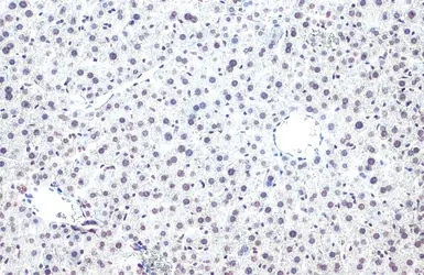 Anti-Histone H2BK20ac (acetyl Lys20) antibody [GT578] used in IHC (Paraffin sections) (IHC-P). GTX633409