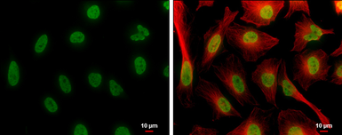 Anti-Histone H4K8ac (acetyl Lys8) antibody [GT478] used in Immunocytochemistry/ Immunofluorescence (ICC/IF). GTX633420