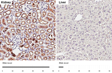 Anti-ATP6V1A antibody [GT3846] used in IHC (Paraffin sections) (IHC-P). GTX633542