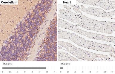 Anti-ATP6V1A antibody [GT3846] used in IHC (Paraffin sections) (IHC-P). GTX633542