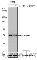 Anti-ATP6V1A antibody [GT1561] used in Western Blot (WB). GTX633544