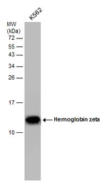 Anti-Hemoglobin zeta antibody [GT1544] used in Western Blot (WB). GTX633545