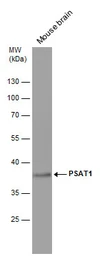 Anti-PSAT1 antibody [GT2918] used in Western Blot (WB). GTX633623