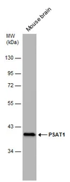 Anti-PSAT1 antibody [GT1353] used in Western Blot (WB). GTX633629