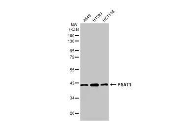 Anti-PSAT1 antibody [GT1353] used in Western Blot (WB). GTX633629