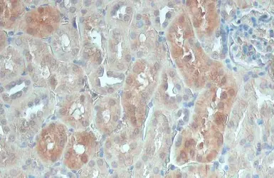Anti-PSAT1 antibody [GT1353] used in IHC (Paraffin sections) (IHC-P). GTX633629