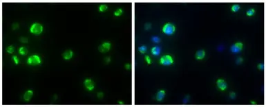 Anti-Dengue virus Capsid protein antibody [GT574] used in IHC (Paraffin sections) (IHC-P). GTX633632