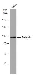 Anti-Gelsolin antibody [GT667] used in Western Blot (WB). GTX633675