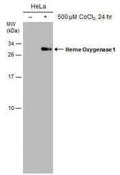 Anti-Heme Oxygenase 1 antibody [GT1334] used in Western Blot (WB). GTX633676