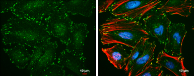 Anti-Paxillin (phospho Tyr118) antibody [GT162] used in Immunocytochemistry/ Immunofluorescence (ICC/IF). GTX633678