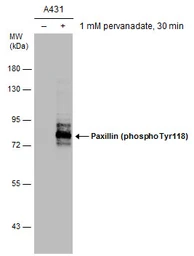 Anti-Paxillin (phospho Tyr118) antibody [GT162] used in Western Blot (WB). GTX633678