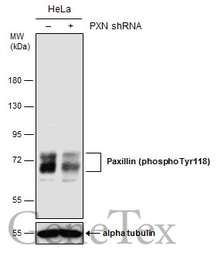 Anti-Paxillin (phospho Tyr118) antibody [GT162] used in Western Blot (WB). GTX633678