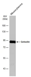 Anti-Gelsolin antibody [GT1656] used in Western Blot (WB). GTX633690