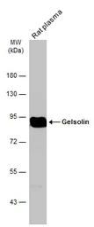 Anti-Gelsolin antibody [GT1656] used in Western Blot (WB). GTX633690