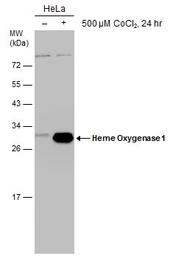 Anti-Heme Oxygenase 1 antibody [GT664] used in Western Blot (WB). GTX633693