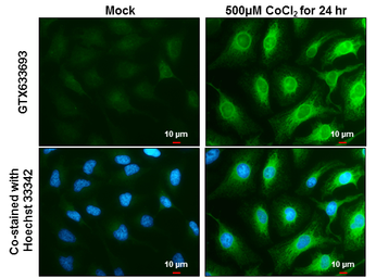 Anti-Heme Oxygenase 1 antibody [GT664] used in Immunocytochemistry/ Immunofluorescence (ICC/IF). GTX633693