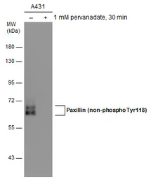 Anti-Paxillin (non-phospho Tyr118) antibody [GT722] used in Western Blot (WB). GTX633707