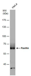 Anti-Paxillin antibody [GT7612] used in Western Blot (WB). GTX633769