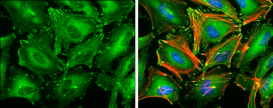 Anti-Paxillin antibody [GT7612] used in Immunocytochemistry/ Immunofluorescence (ICC/IF). GTX633769