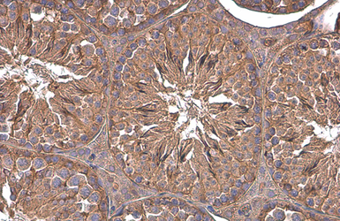 Anti-Paxillin antibody [GT7612] used in IHC (Paraffin sections) (IHC-P). GTX633769