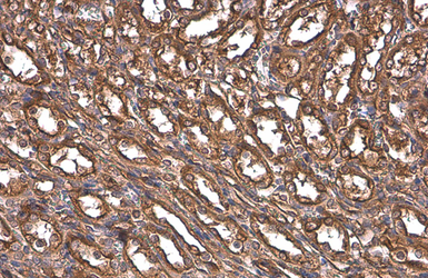 Anti-Paxillin antibody [GT7612] used in IHC (Paraffin sections) (IHC-P). GTX633769