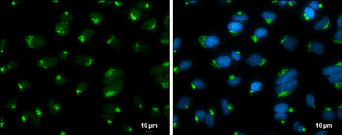 Anti-GOLGA5 antibody [GT2726] used in Immunocytochemistry/ Immunofluorescence (ICC/IF). GTX633810