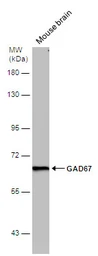 Anti-GAD67 antibody [GT1982] used in Western Blot (WB). GTX633816