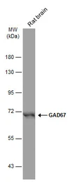 Anti-GAD67 antibody [GT1982] used in Western Blot (WB). GTX633816