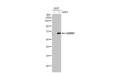 Anti-GAD67 antibody [GT1982] used in Western Blot (WB). GTX633816