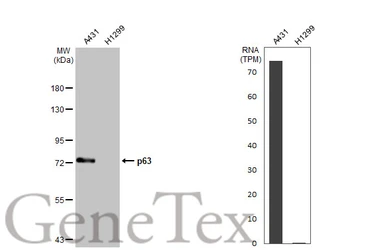 Anti-p63 antibody [GT1179] used in Western Blot (WB). GTX633818