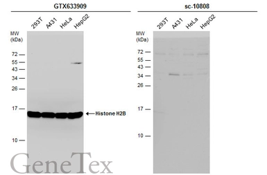 Anti-Histone H2B antibody [GT387] used in Western Blot (WB). GTX633909