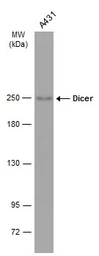 Anti-Dicer antibody [GT1176] used in Western Blot (WB). GTX633917