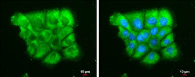 Anti-Dicer antibody [GT1176] used in Immunocytochemistry/ Immunofluorescence (ICC/IF). GTX633917